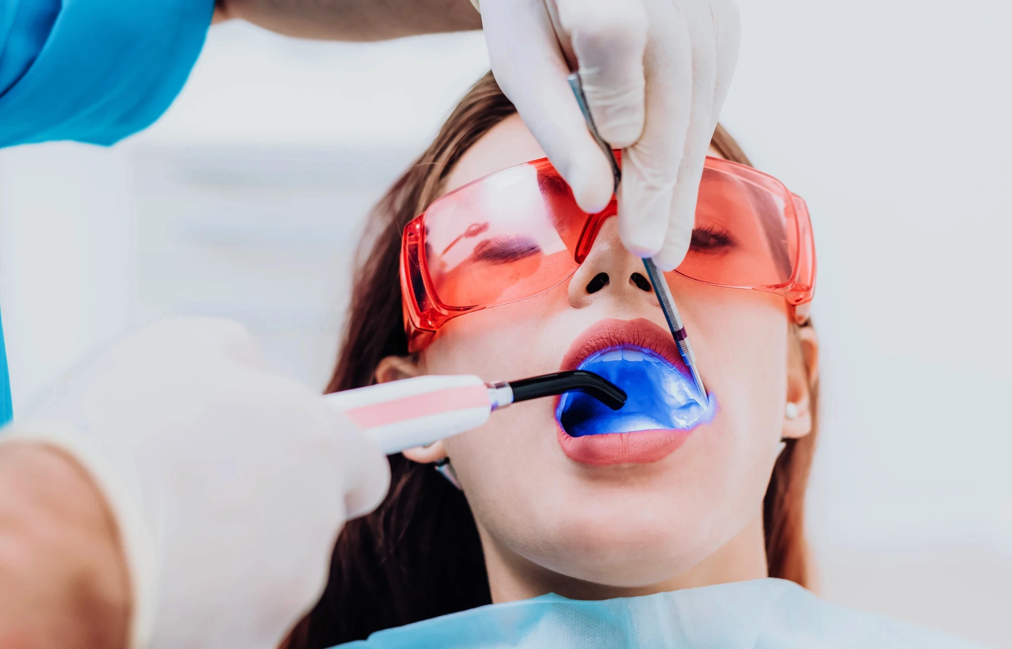 Kobieta z uśmiechem prezentująca efekty bondingu na swoich zębach.