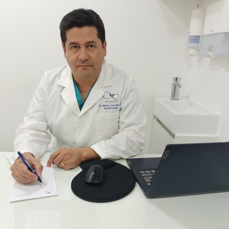 Alopecia androgenetica masculina. Tratamientos para la caida del pelo