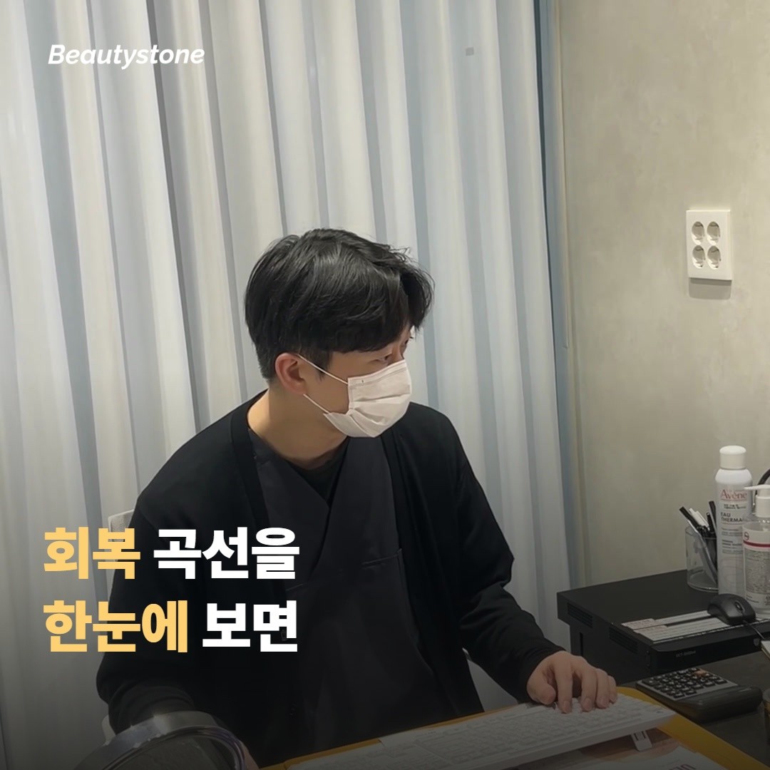 회복 곡선을 한눈에 보면