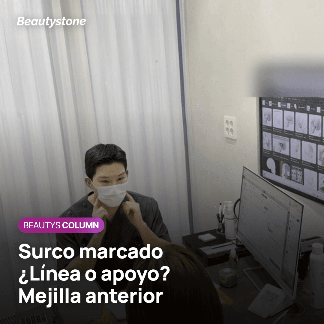 Relleno en la línea del surco frente a soporte en la mejilla anterior