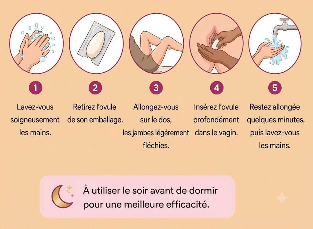 comment utiliser un ovule antifongique