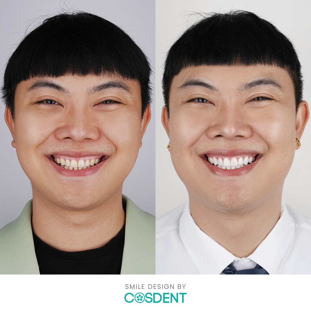 ผลงานการเปลี่ยนแปลงรอยยิ้มที่ COSDENT