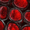 Fibroids have been associated with sustained increases in atherosclerotic cardiovascular disease risk, with some research showing elevated risk persisting for up to a decade after diagnosis [10].