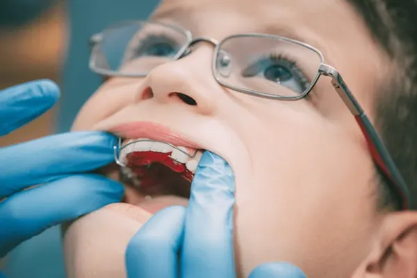 Intraoral Cameras