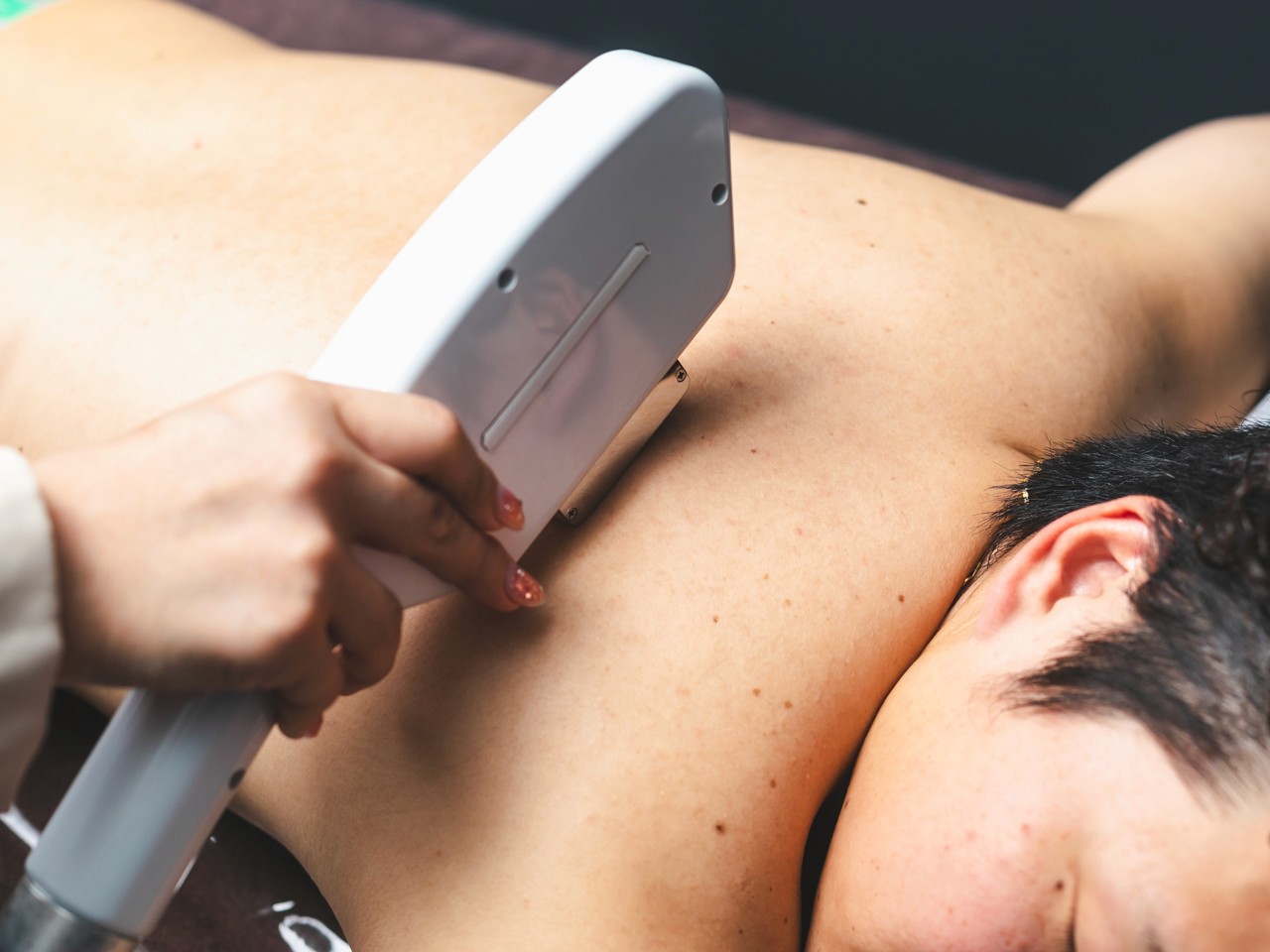 一宮市 メンズ脱毛 ヒゲ脱毛