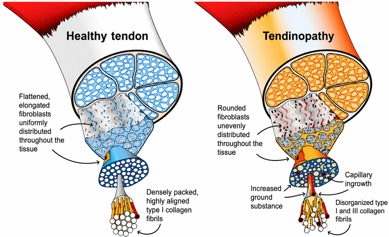 sports injury Auckland