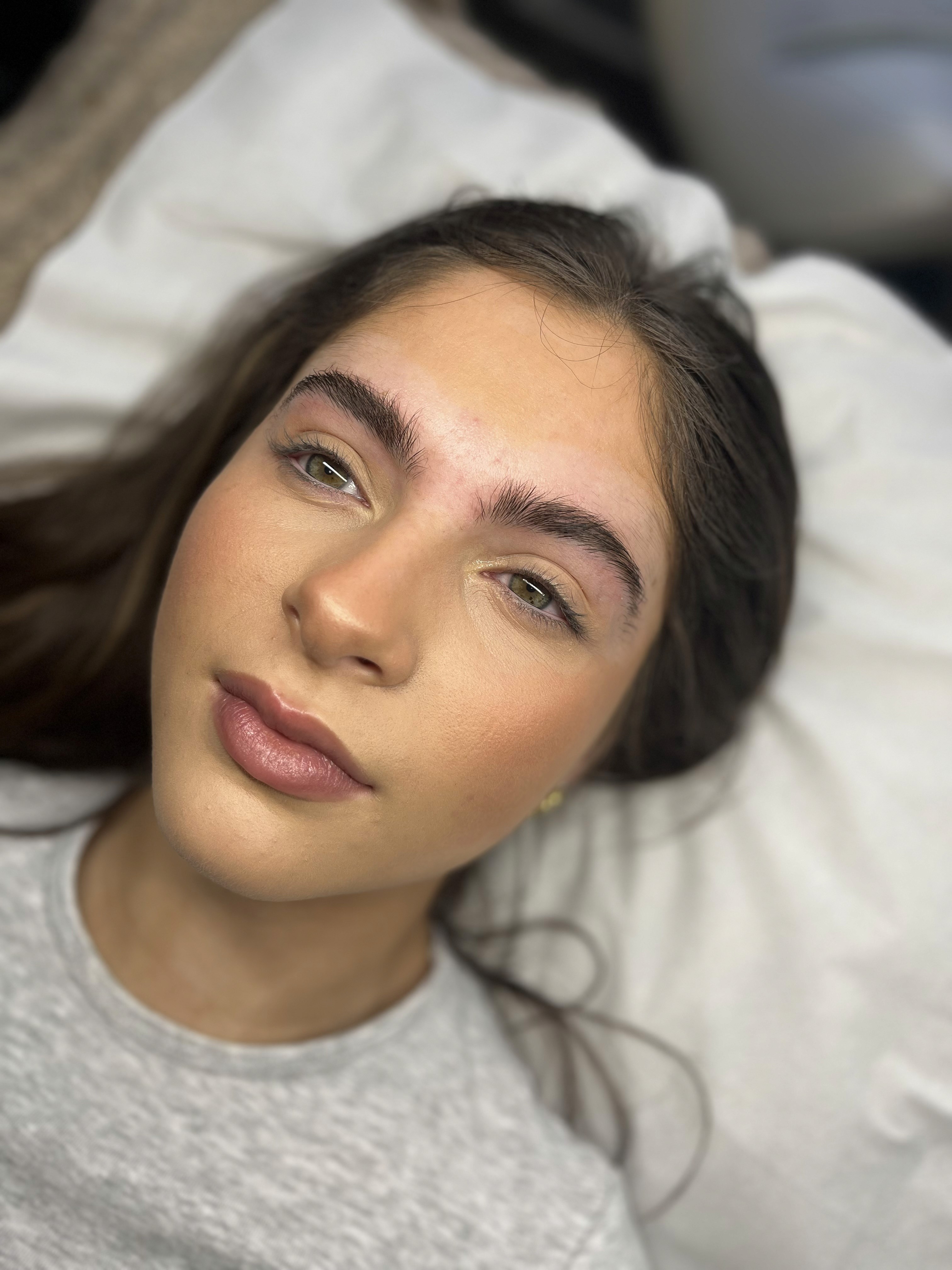 bushy eyebrows before treatment