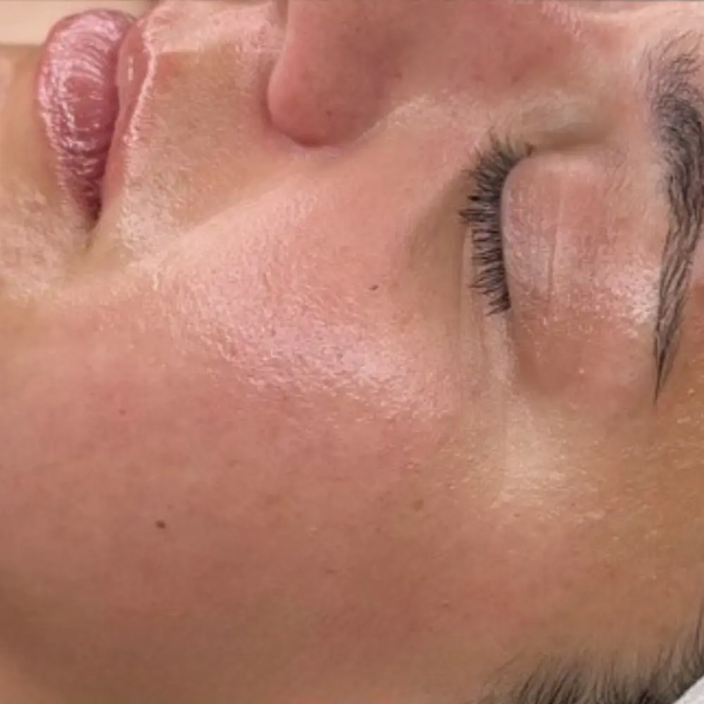 After lymphatic drainage facial at The Vancouver Aesthetician — fine lines visibly softened, skin deeply hydrated and complexion noticeably more plump and refreshed