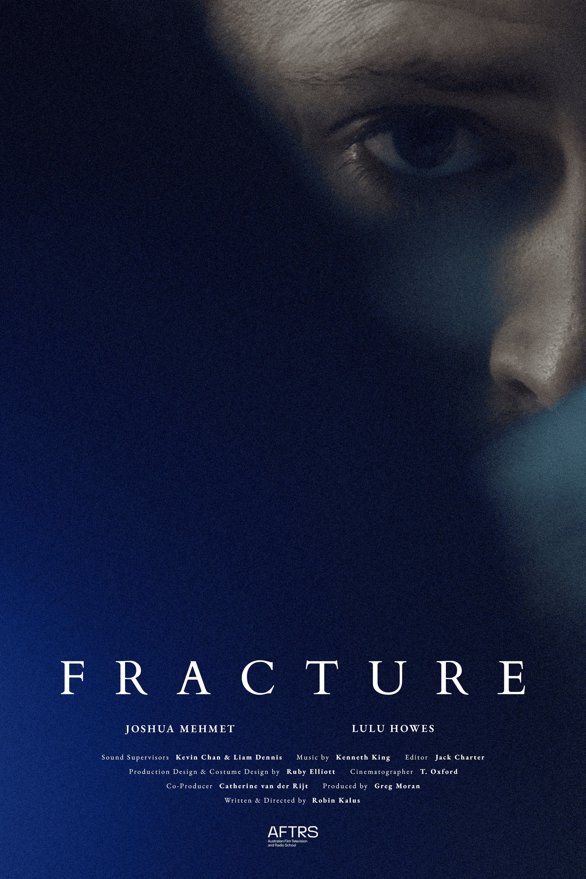 Fracture poster placeholder