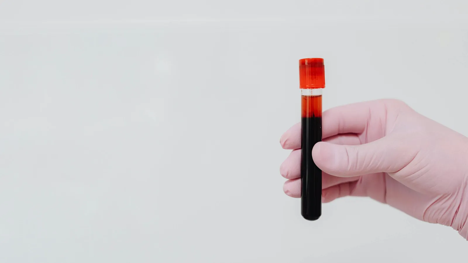 alkaline phosphatase levels explained