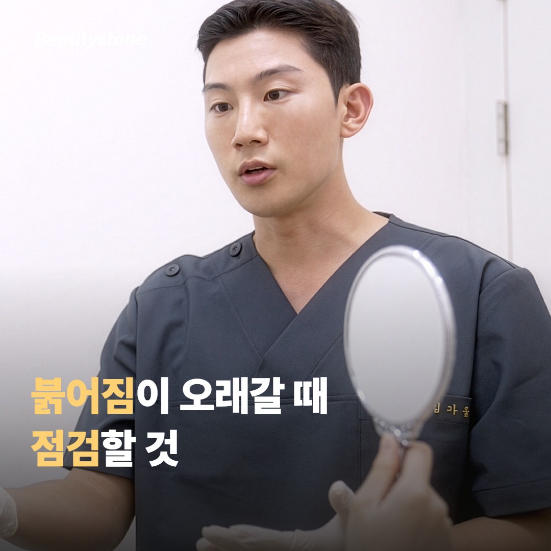 붉어짐이 오래갈 때 점검할 것