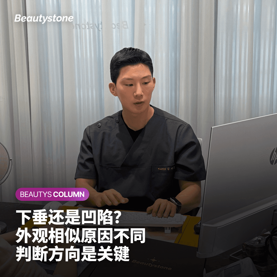 额头埋线提升的适用范围