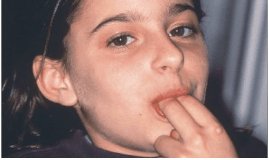 oral_habits
