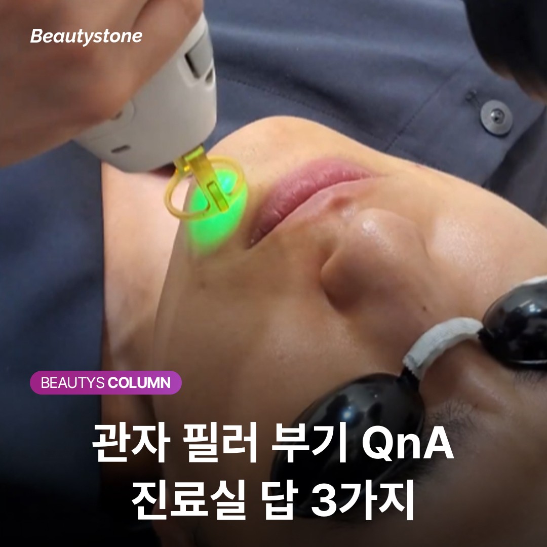 실제 질문 베스트 3: 관자 필러 효과 시기, 유지기간, 잔통의 모든 것