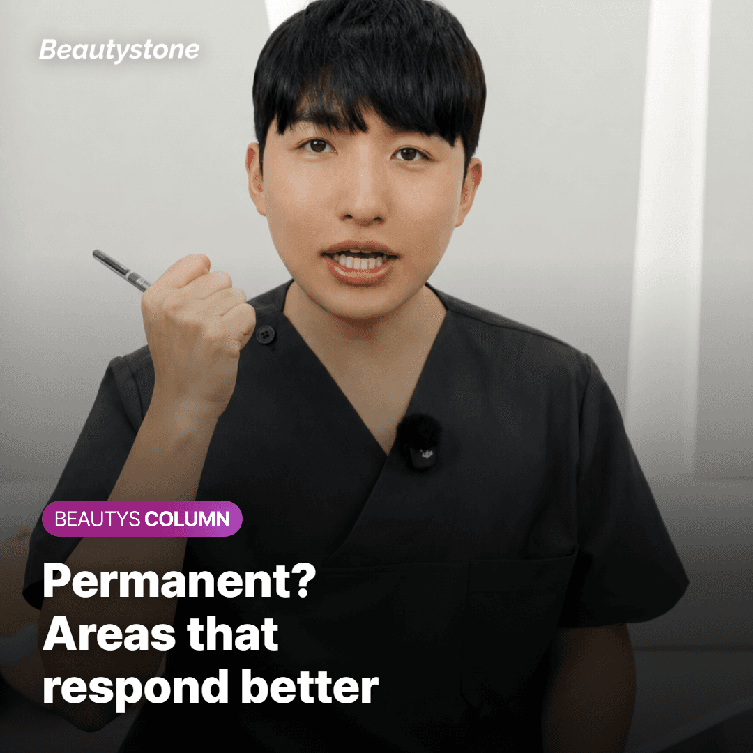Is It Permanent, and Which Areas Respond Better?