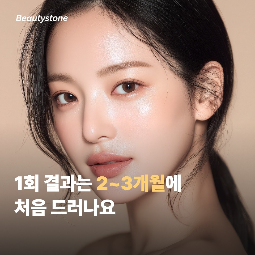 울쎄라 프라임 1회로 결과가 어떻게 나오나요?