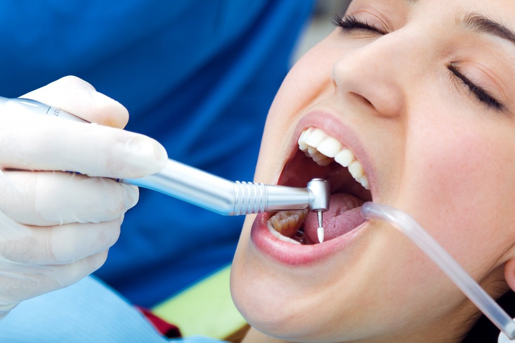 teeth cleaning service in hong kong