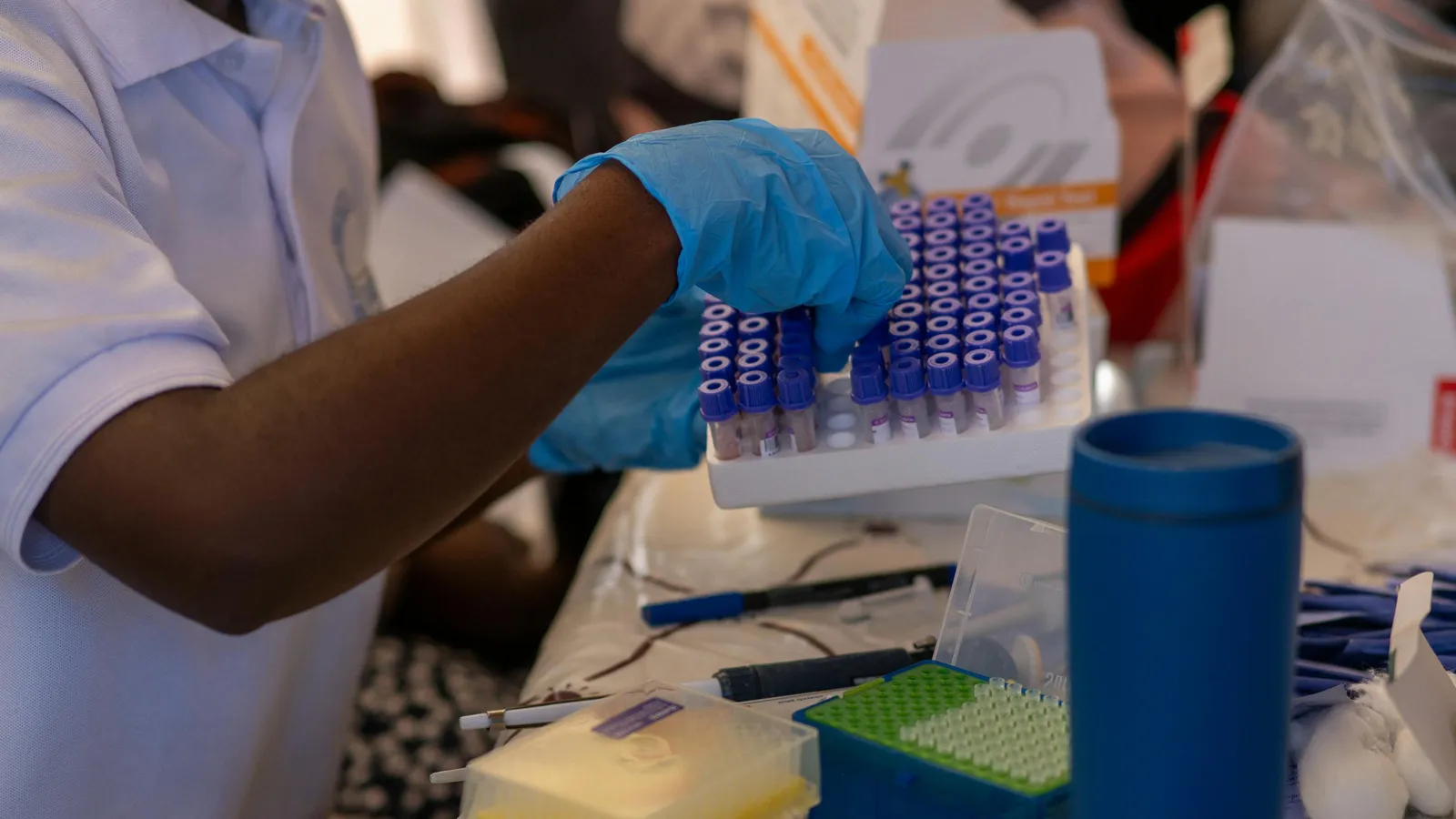 What Bilirubin in Urine Does Not Mean