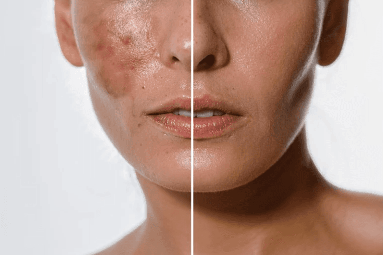 A young woman with wet hair, leaning back in a bath with her eyes closed. The sunlight reflects off the water, creating a serene and tranquil atmosphere.