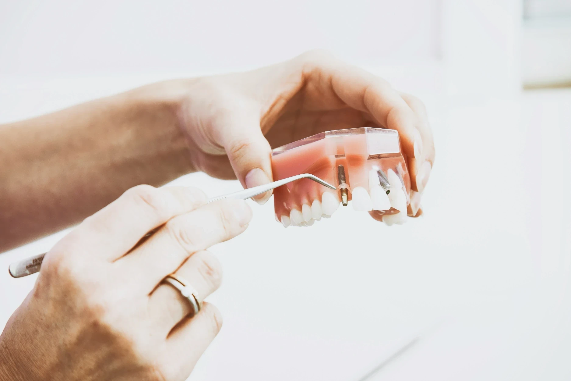 Endpoints in Oral Implantology: It's Time to Set the Bar Higher | Bloor-Yorkville Periodontics