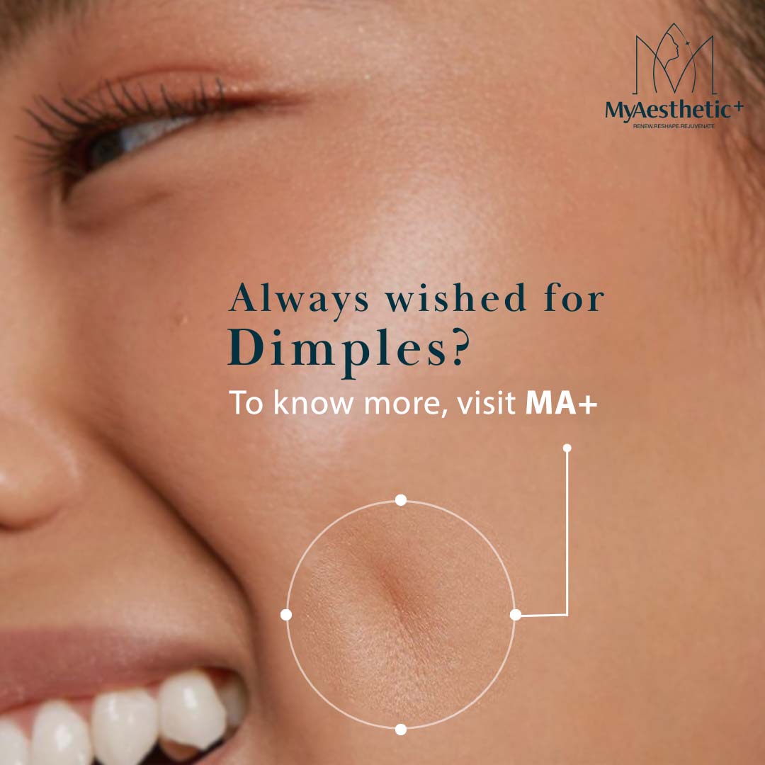 Example work of framer development