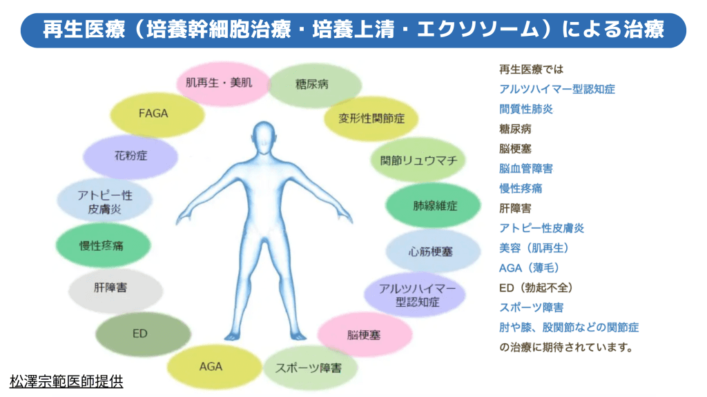 再生医療による治療