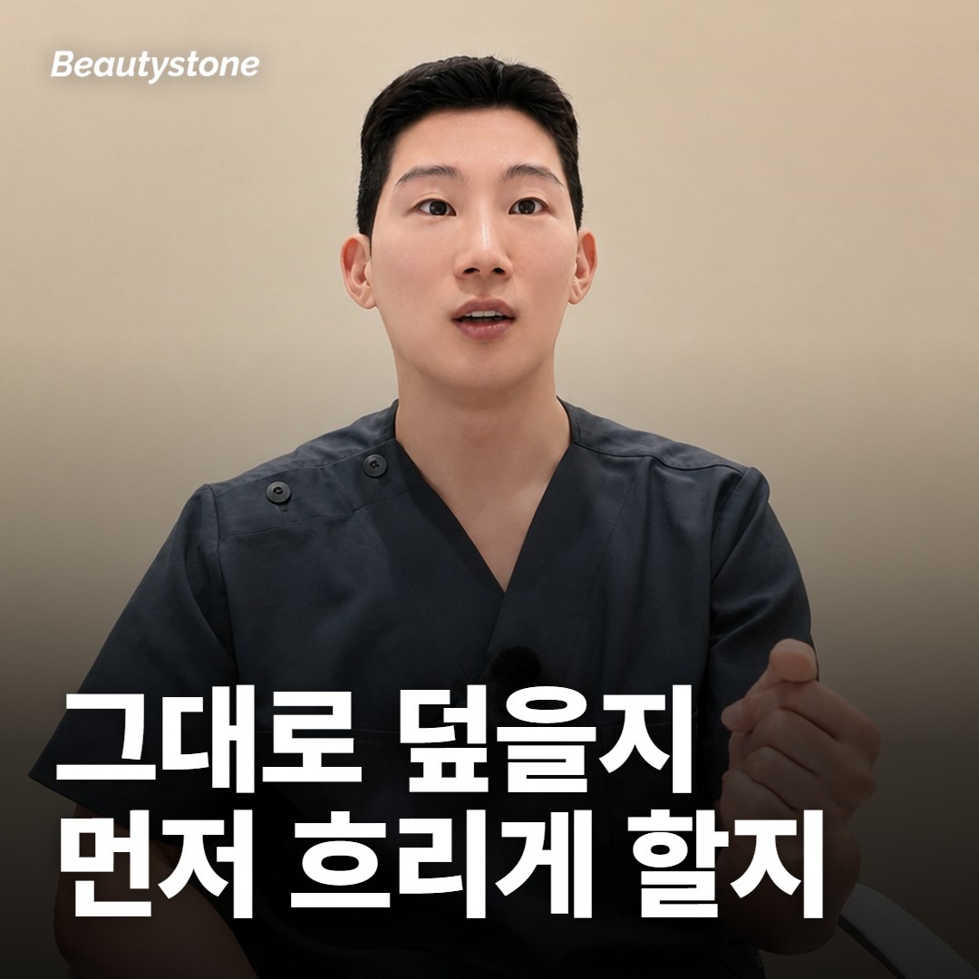 그대로 덮을지, 먼저 흐리게 할지 가르는 기준