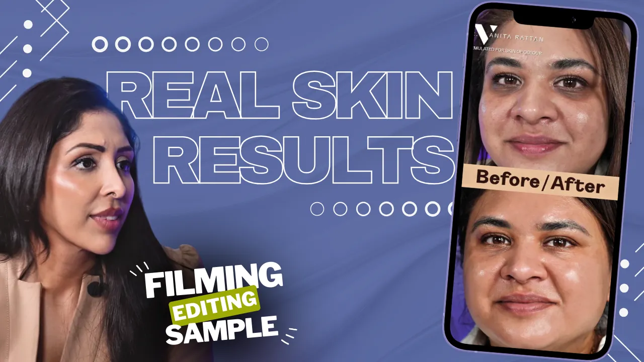 Before and after skincare consultation video produced by a professional video production company in London, featuring real client results and natural on-camera discussion.