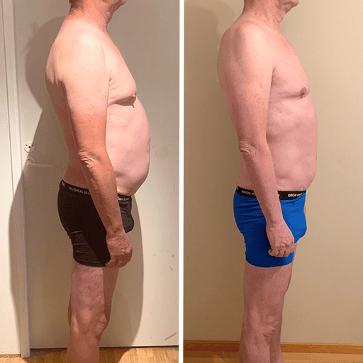 Före- och efterjämförelse av en man som gick ner i vikt med RE:YOU-programmet