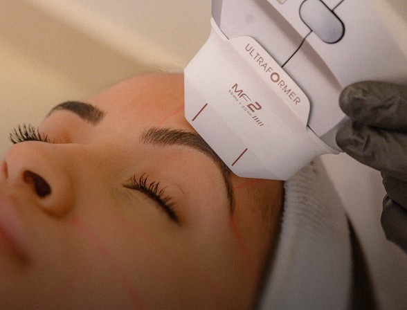 Ultrassom Microfocado (Ultraformer MPT)