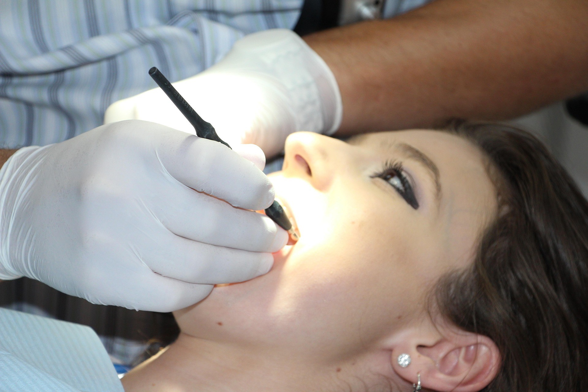Deep teeth cleaning in Abu Dhabi.