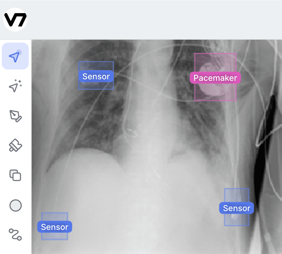 AI assisted data labeling in v7