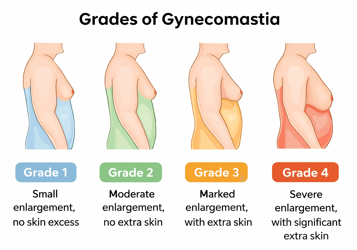 Circumcision recovery stages timeline