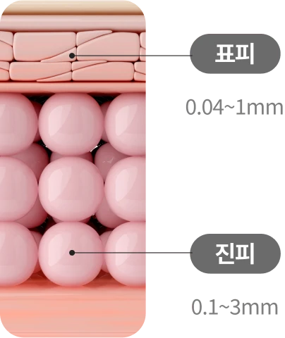 피부_올타이트_가열원리_인포그래픽_르샤인
