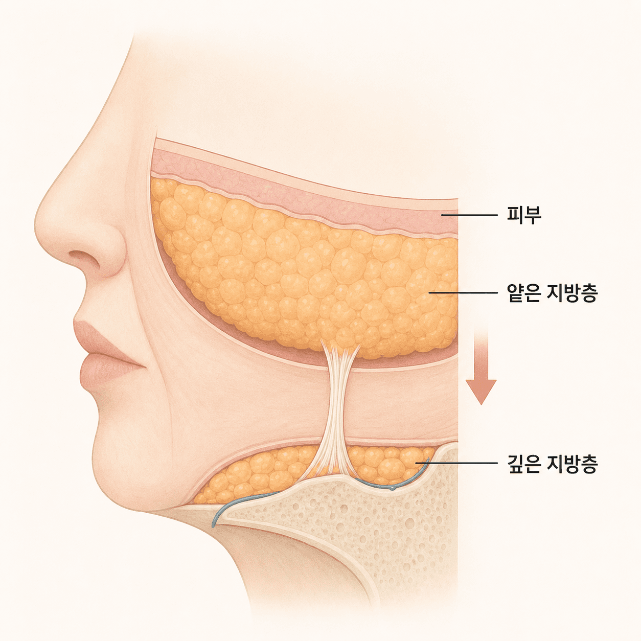 다이어트 후 깊은 지방층이 줄며 볼이 꺼지는 구조