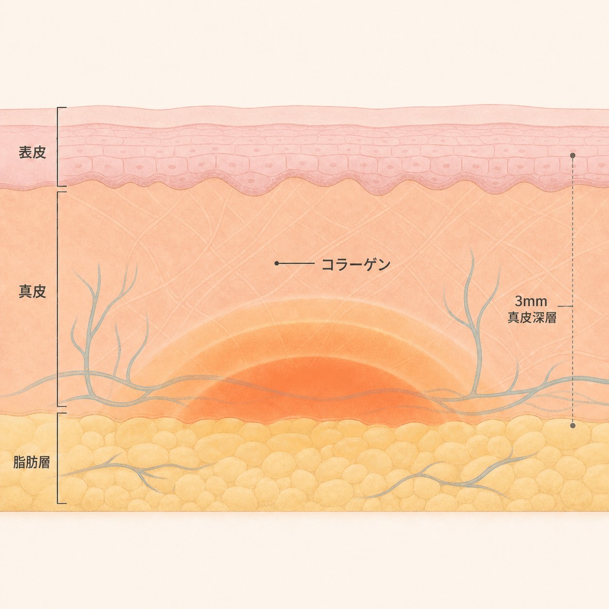 肌の下の層に伝わった熱とコラーゲン刺激の構造