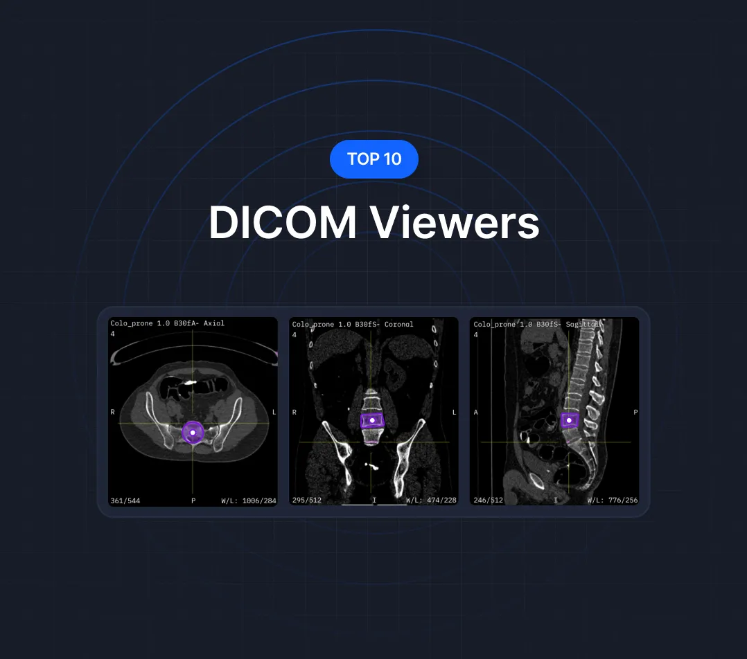 Image of DICOM Viewers