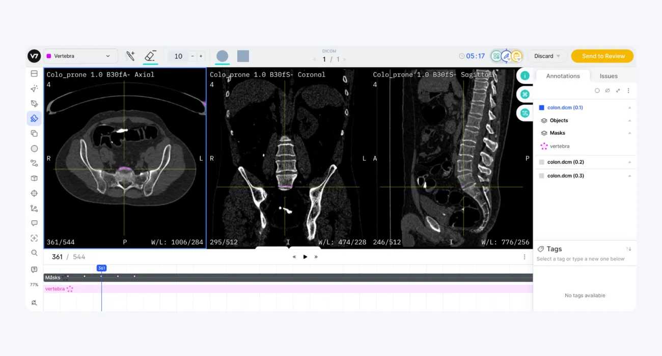 DICOM image in V7 Darwin