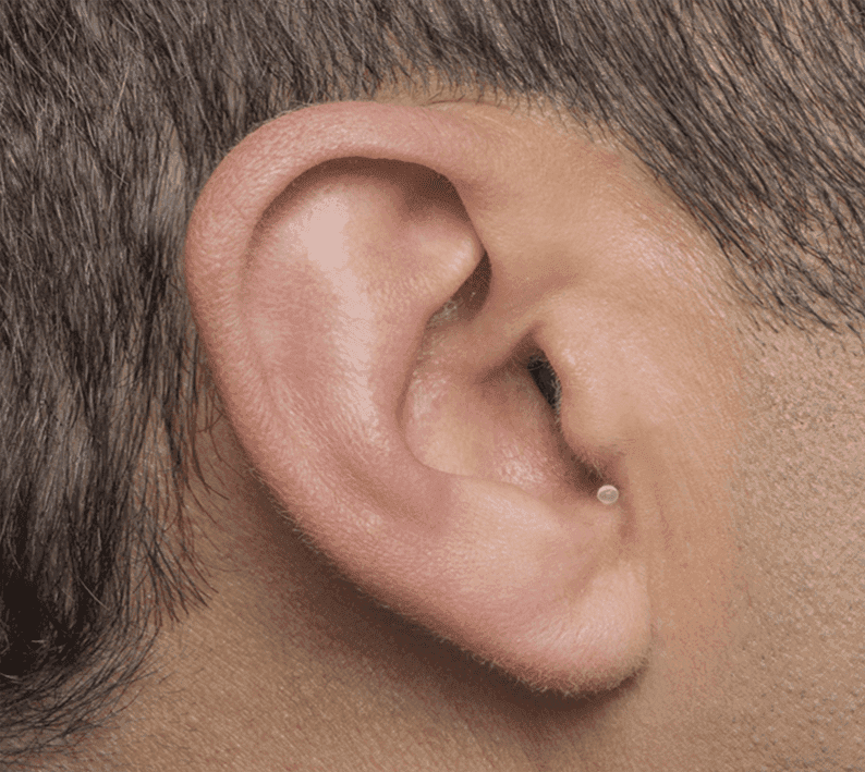Doctor checking a male patient's hearing