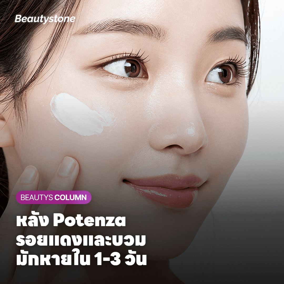 Potenza เหมาะกับปัญหาผิวแบบไหน?