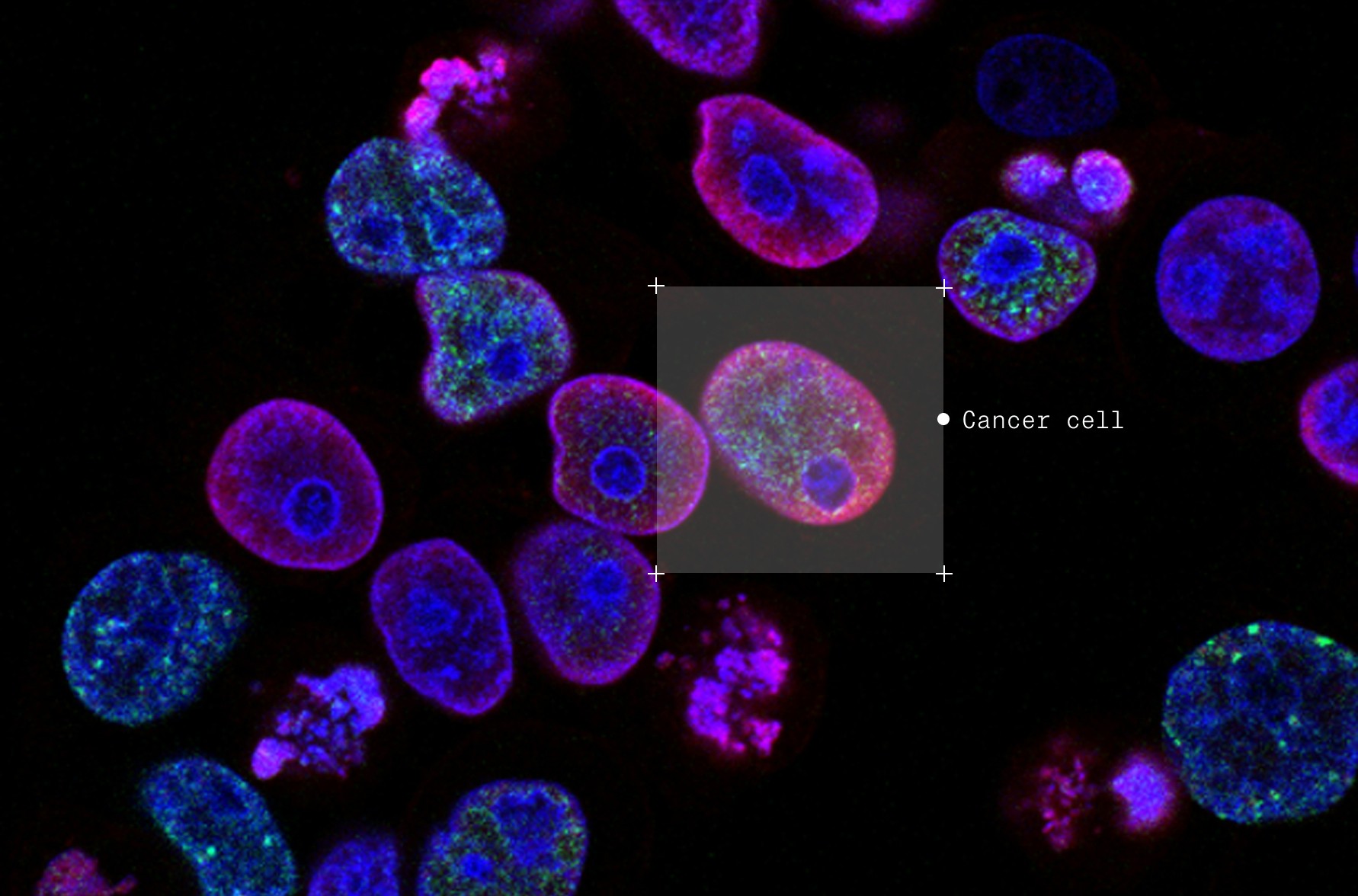 Annotated cancer cells