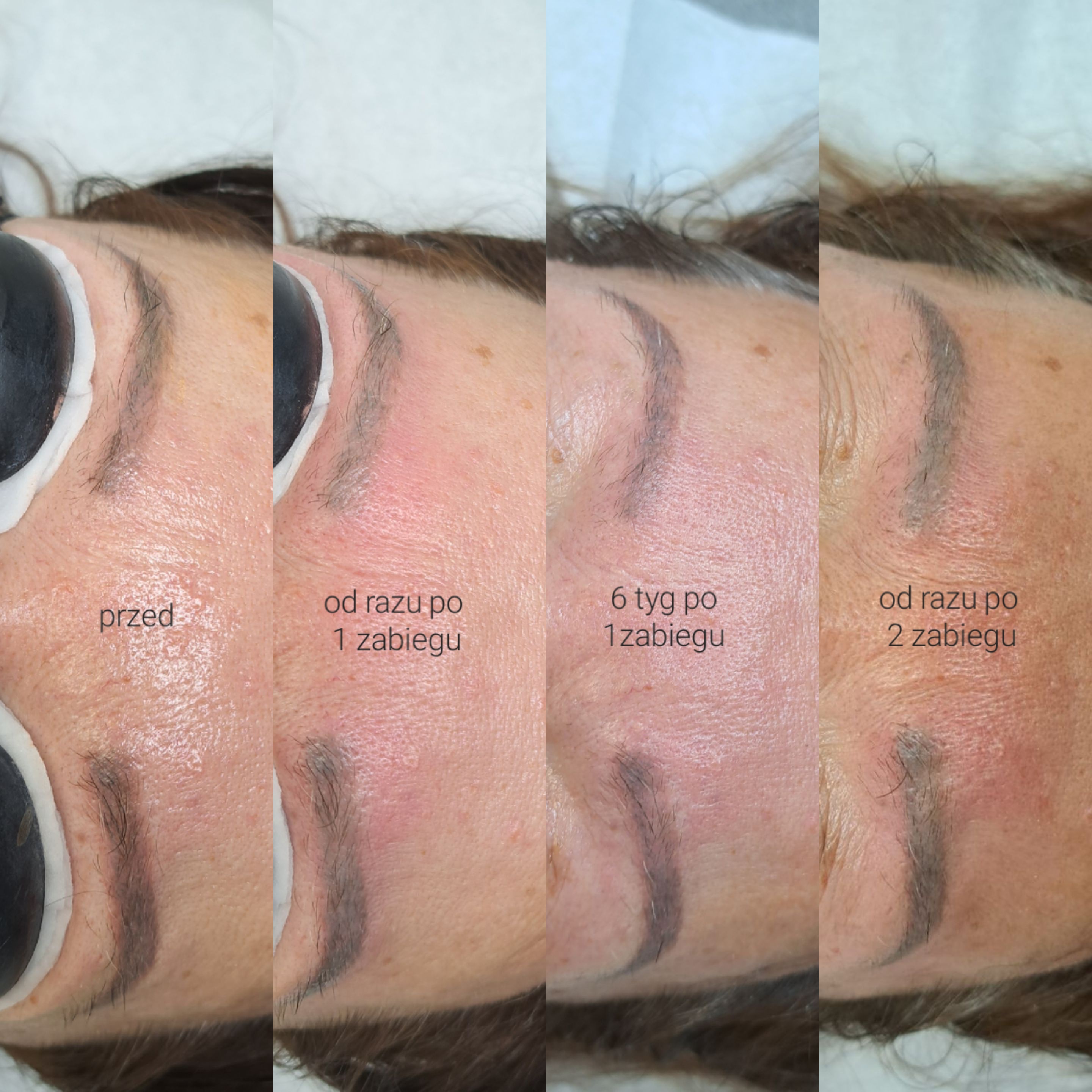 Leszczenko Beauty - efekty pacjentów