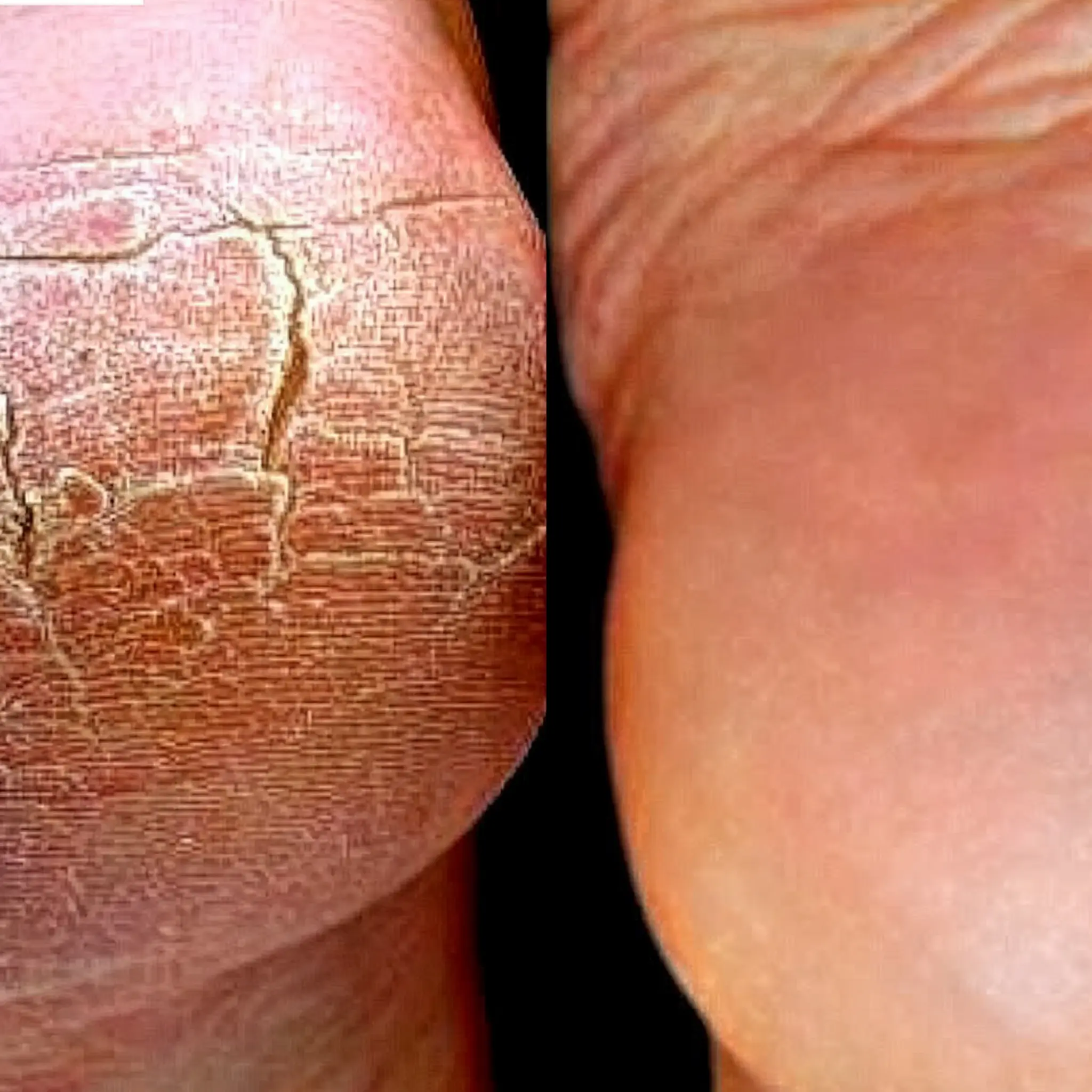 Before and after treatment - face