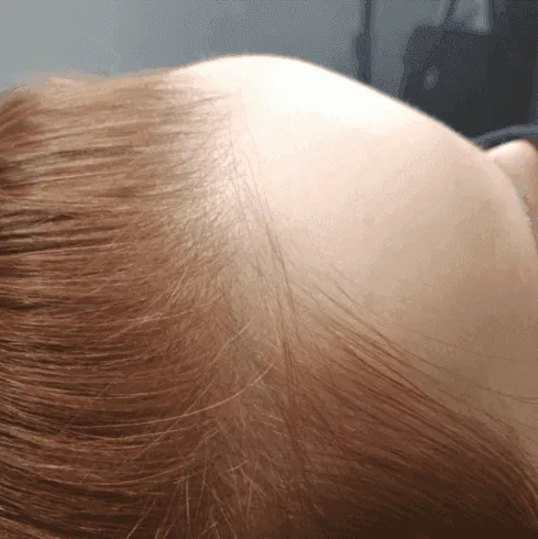 Hair After