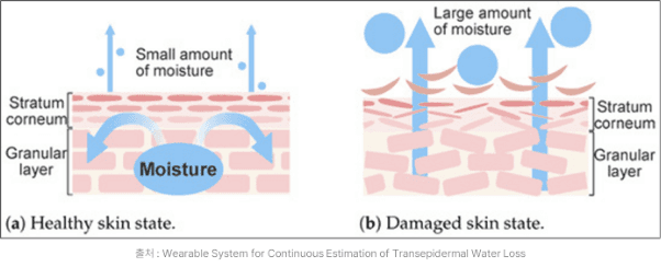 dry indoor heating environments cause moisture loss