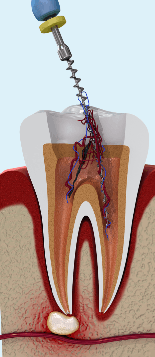 Work-Life Balance Couching