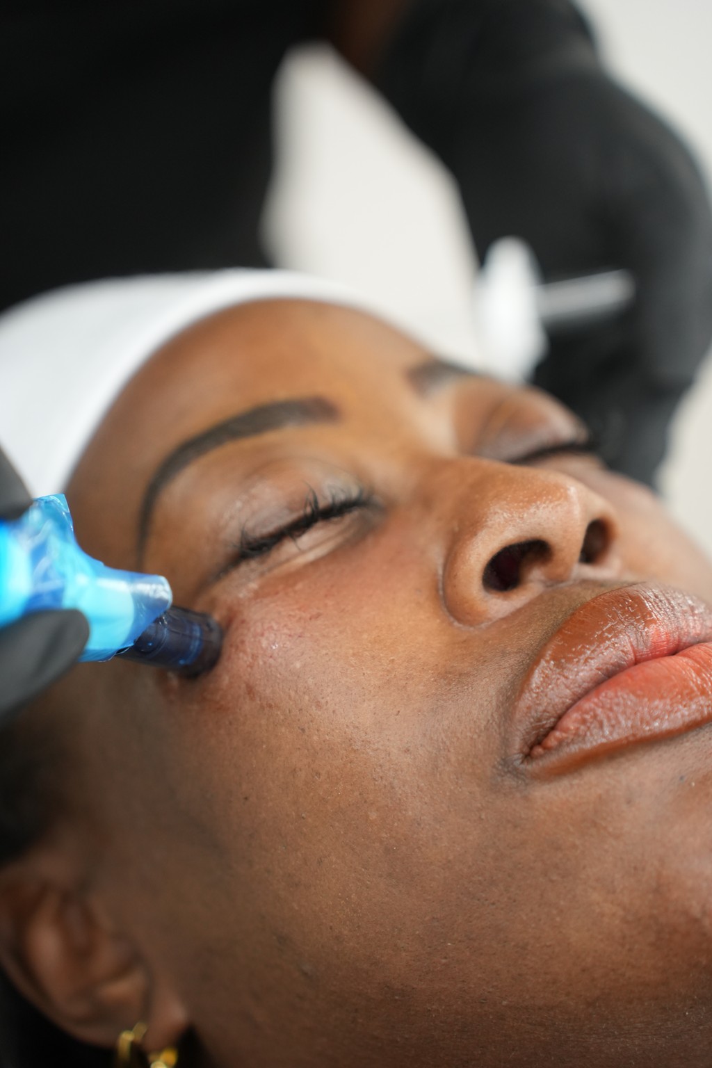 Person receiving a gentle facial skin treatment