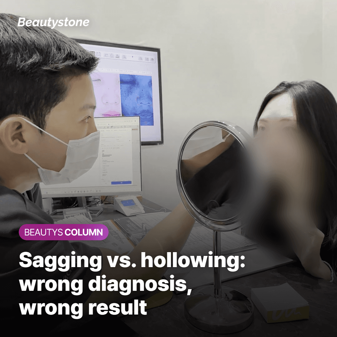 Where Thread Lifting Falls Short — and Why It's Not Always the Right Answer