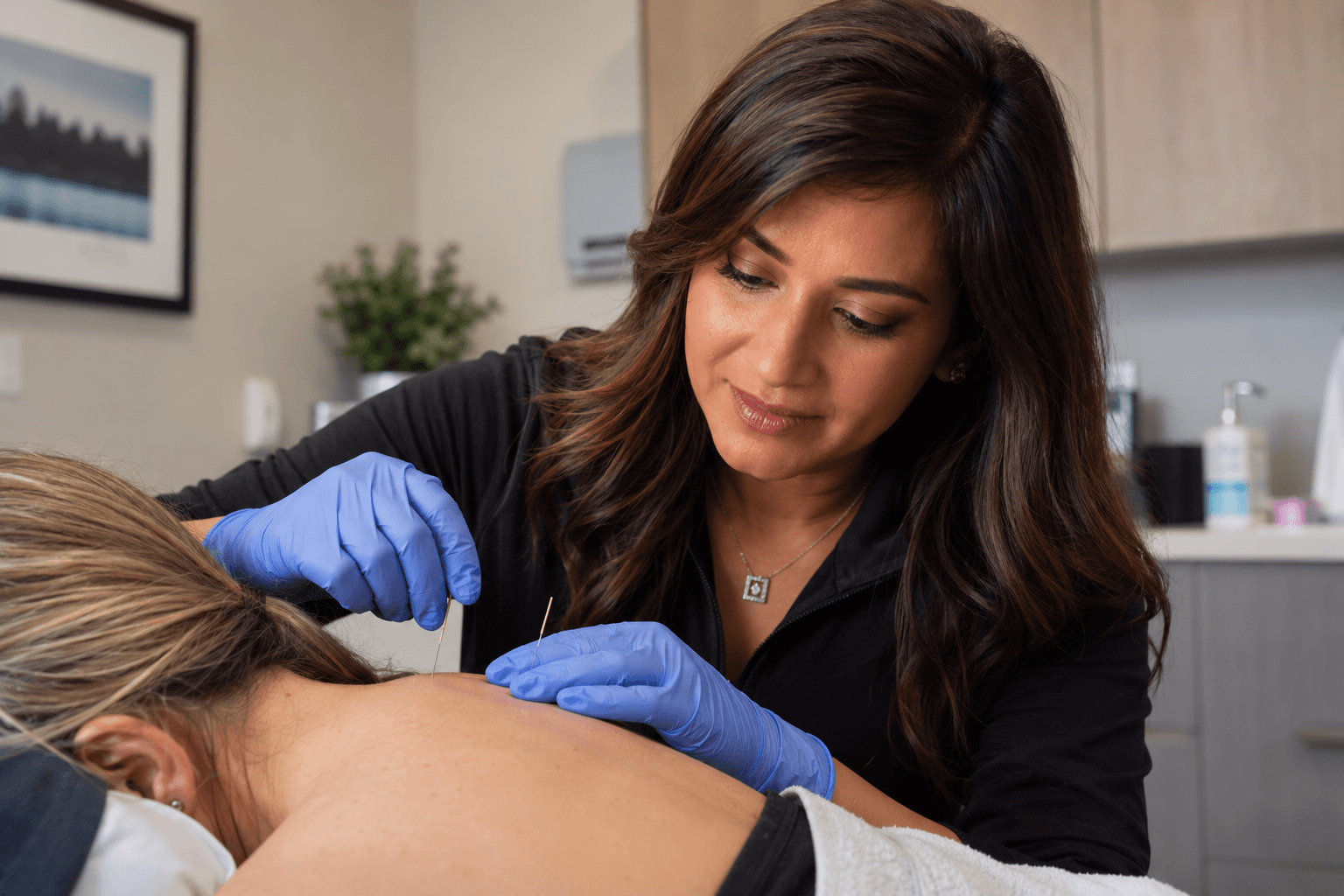 Physical therapist performing dry needling treatment for muscle pain