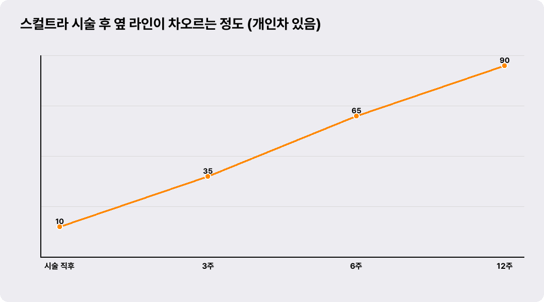 스컬트라 시술 후 옆 라인이 차오르는 정도 (개인차 있음)